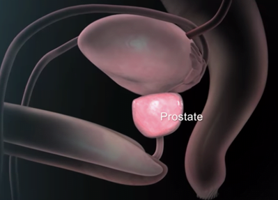 bph_prostate